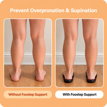 Pro Arch Support Insoles